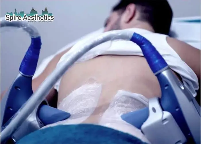Man having fat freezing treatment done on love handles before a competitions England to create a sculpted look.