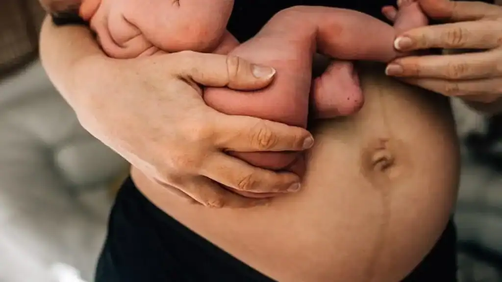 Why Is My Stomach Still Big After Pregnancy England?