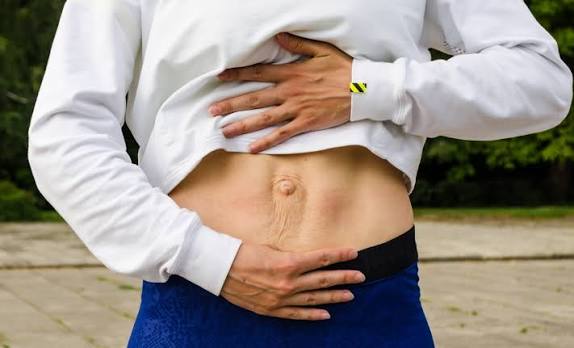 When Could Diastasis Recti Be the Missing Piece of the Puzzle England?